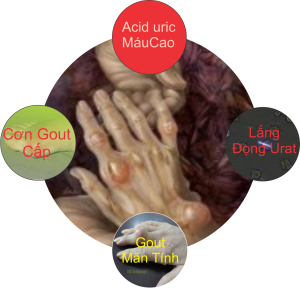 Ăn uống để phòng bệnh gút 2 chế độ ăn cho người bệnh gút - hình minh họa 2