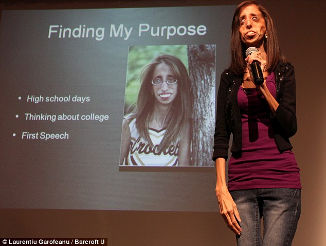Lizzie Velasquez truyền cảm hứng - hình minh họa 3