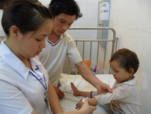 7 rủi ro sức khỏe thường gặp nhất vào mùa hè 2 Nắng Vàng Gọi Mời, Sức Khỏe Vững Vàng - hình minh họa 2
