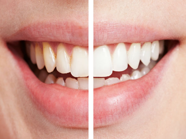 8 công dụng bất ngờ của vỏ chuối đối với sức khỏe Phunungaynay.net công dụng vỏ chuối