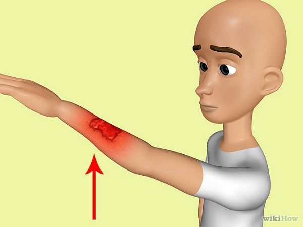 Tranh vẽ: 7 kỹ năng cứu người ai cũng cần biết 22 Sức Mạnh Diệu Kỳ Của - hình minh họa 19