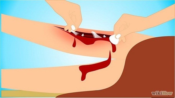 Tranh vẽ: 7 kỹ năng cứu người ai cũng cần biết 19 Sức Mạnh Diệu Kỳ Của - hình minh họa 10