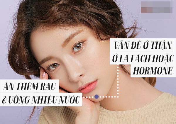 Ăn gì để trị mụn hiệu quả và dứt điểm?