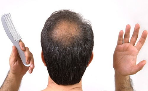 lô hội trị rụng tóc - hình minh họa 2
