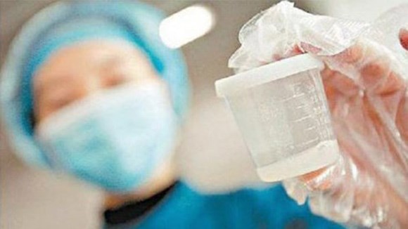 phương pháp làm đẹp nguy hại - hình minh họa 2