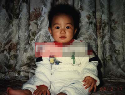 lee min ho thẩm mỹ