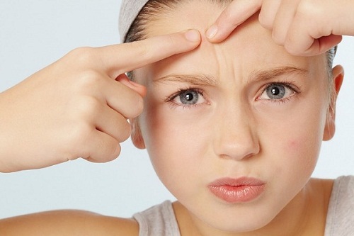 sai lầm khi trị mụn trứng cá