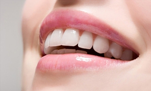 Bí Quyết Sở Hữu Nụ Cười Rạng Rỡ Tự Nhiên - hình minh họa 2